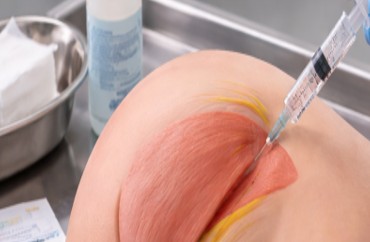 Intramuscular and Injection Hip